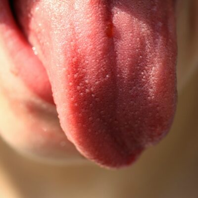tongue-822441_1280 tongue-822441_1280